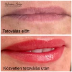 száj4