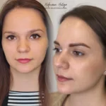 közvetlen tetoválást utáni szemöldök