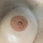 Areola